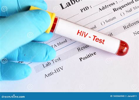 hiv positive results images|Hiv Positive Photos and Images .